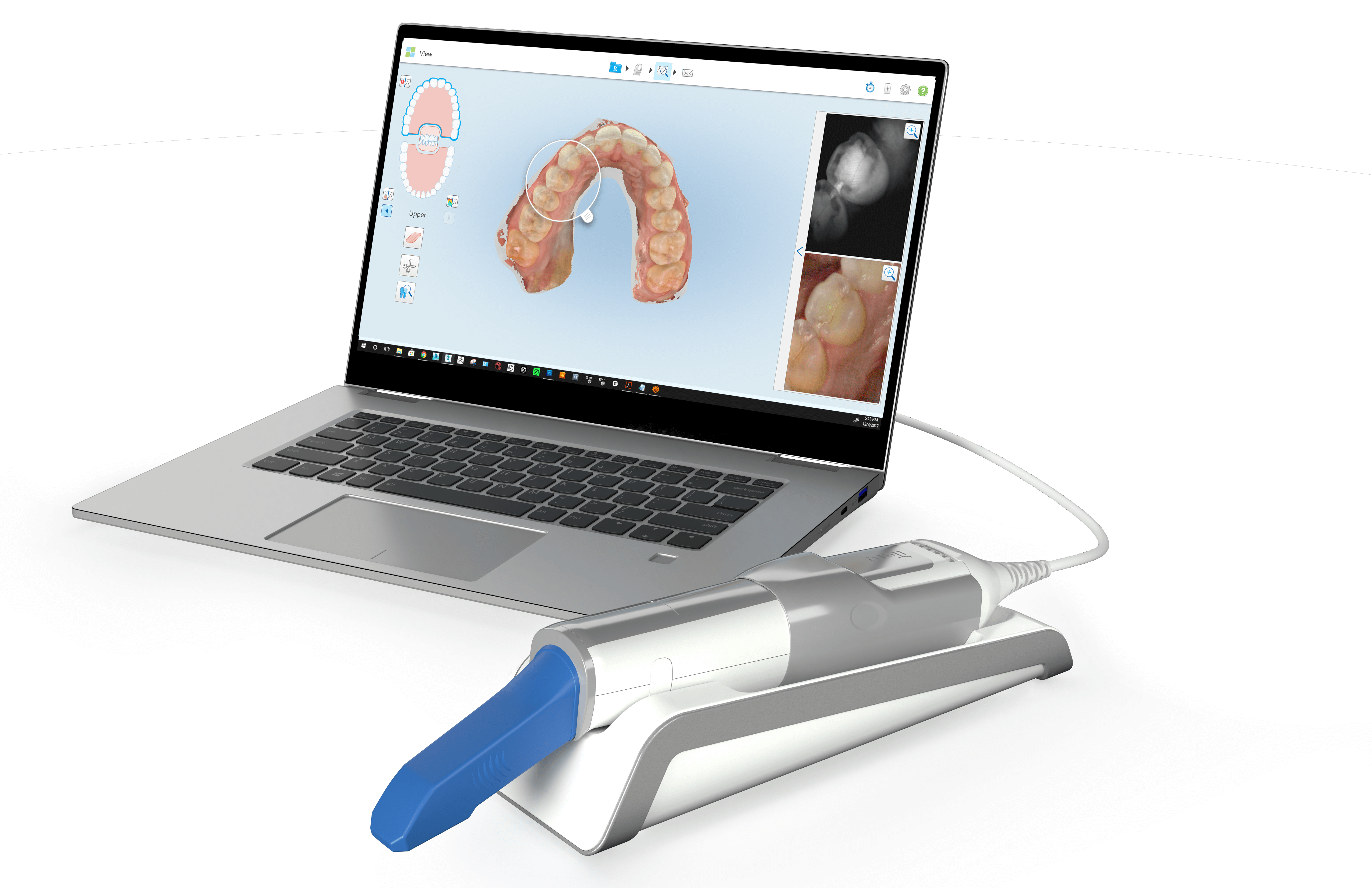 What Is The iTero Element® Scanner?